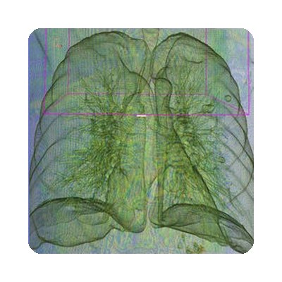 Medical imaging example